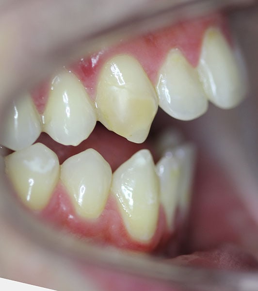 DR. HESSLING Kieferorthopädie Zähne schonend ✚ erhalten